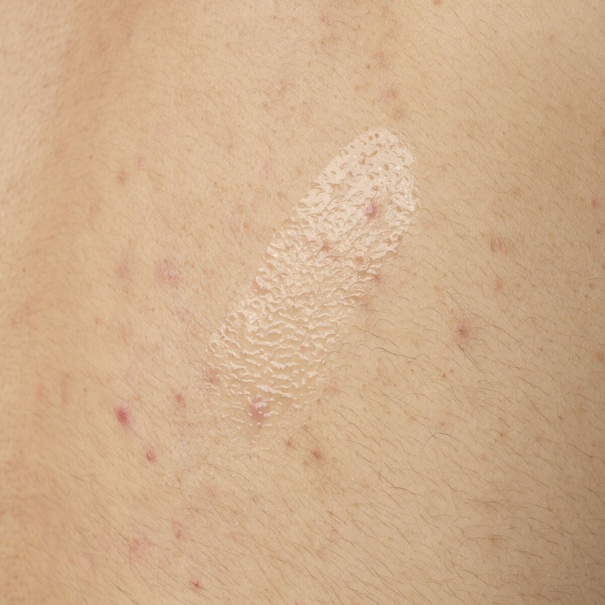 salicylic-acid-0-5-body-serum-n0 ORD-salicylic-acid-05-body-240ml-application.jpg