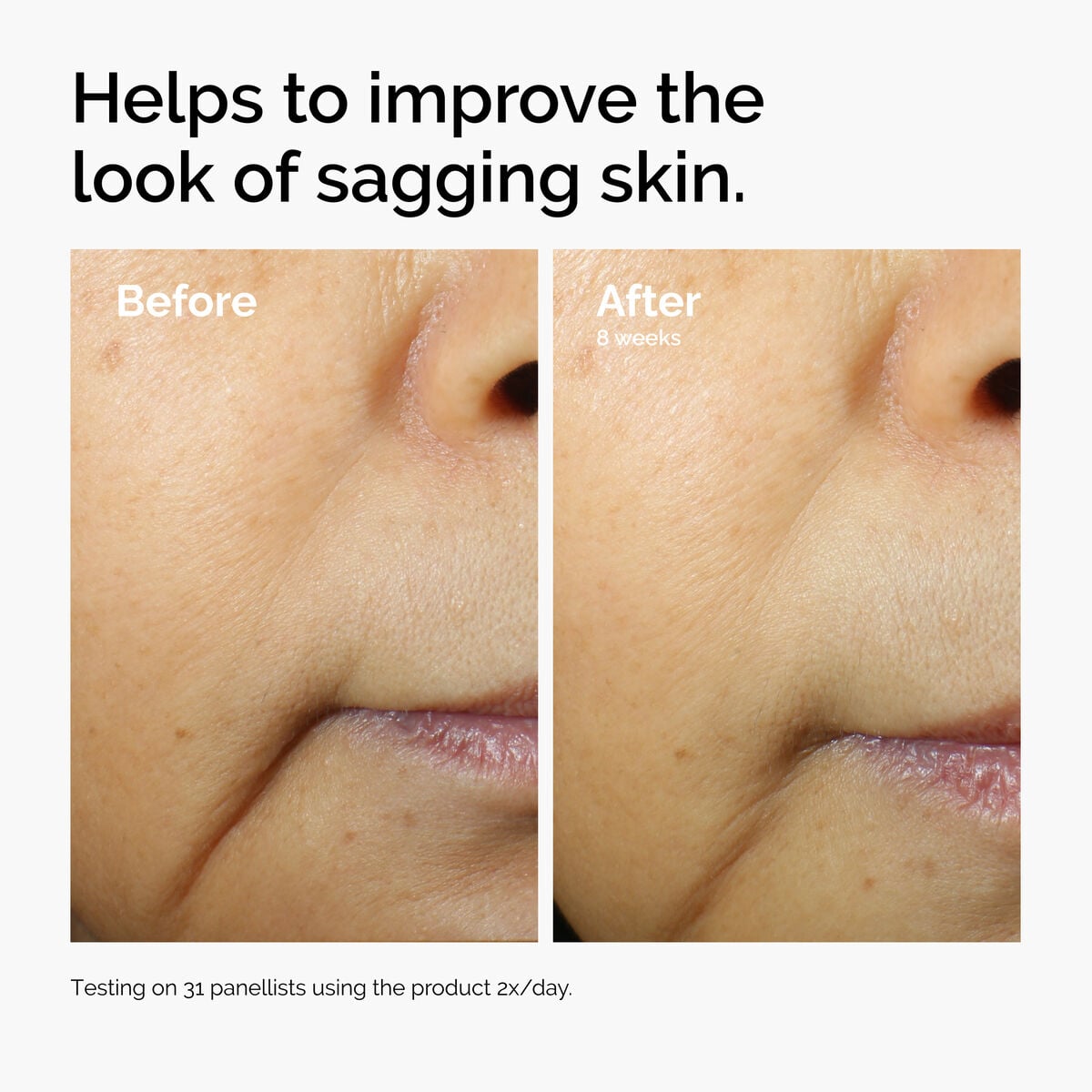 caffeine-3-escin-1-face-serum-w9 ord-caffeine-3pct-escin-1pct-face-serum-before-after-sagging.jpg