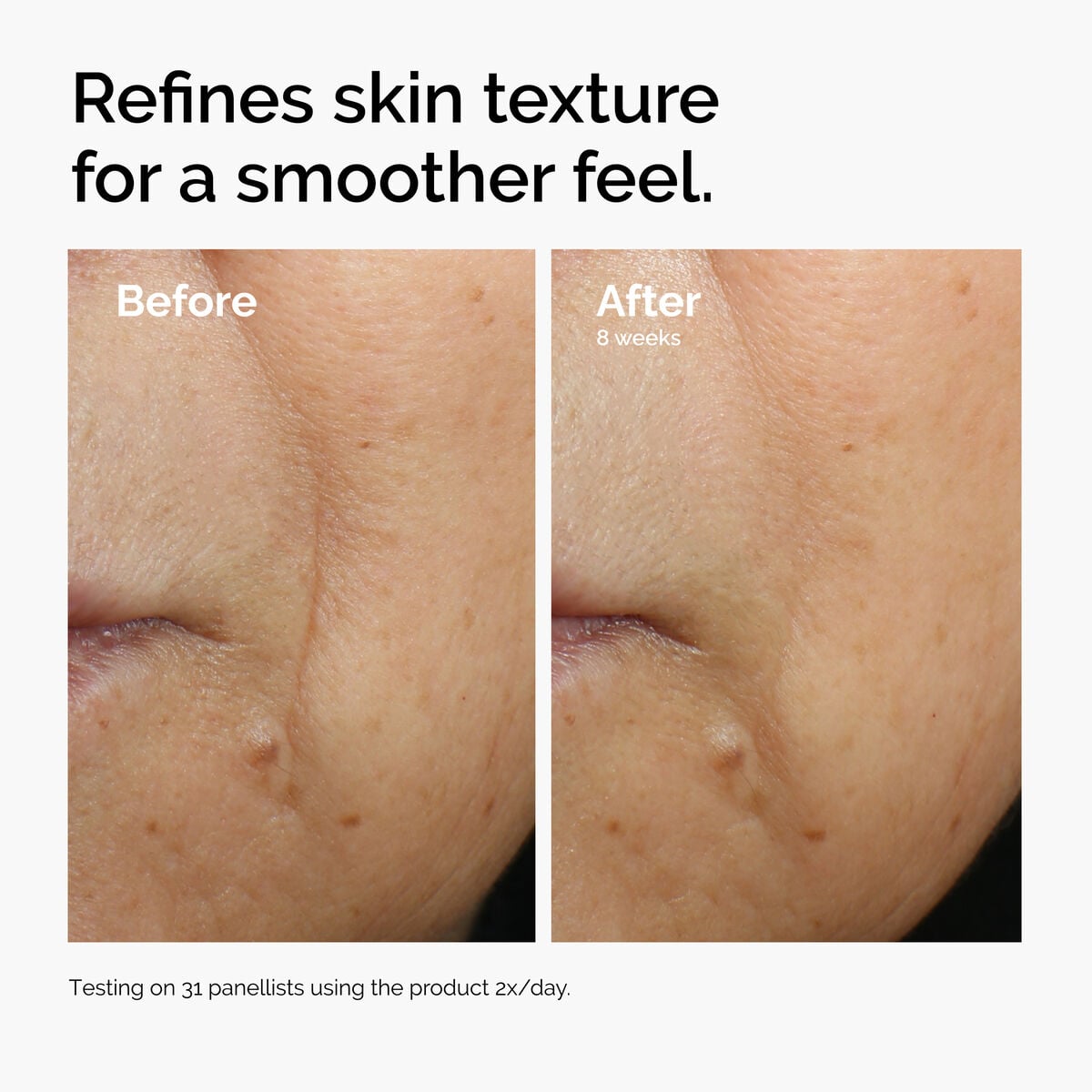caffeine-3-escin-1-face-serum-w9 ord-caffeine-3pct-escin-1pct-face-serum-before-after-texture.jpg