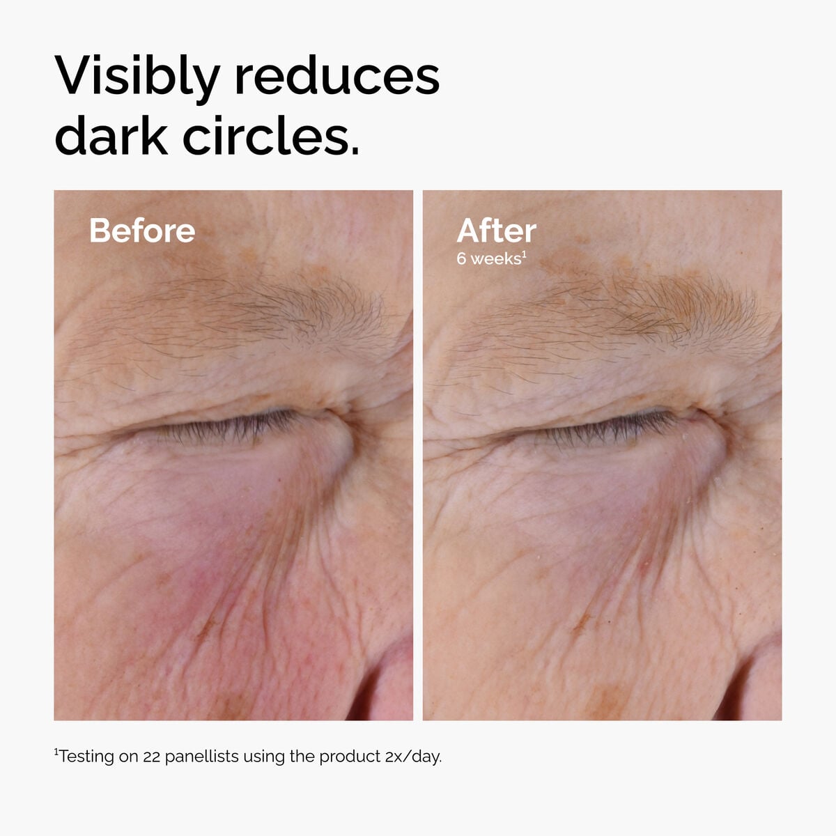 caffeine-solution-5-egcg-eye-serum-e4 ord-caffeine-solution-egcg-dark-circles-before-after.jpg