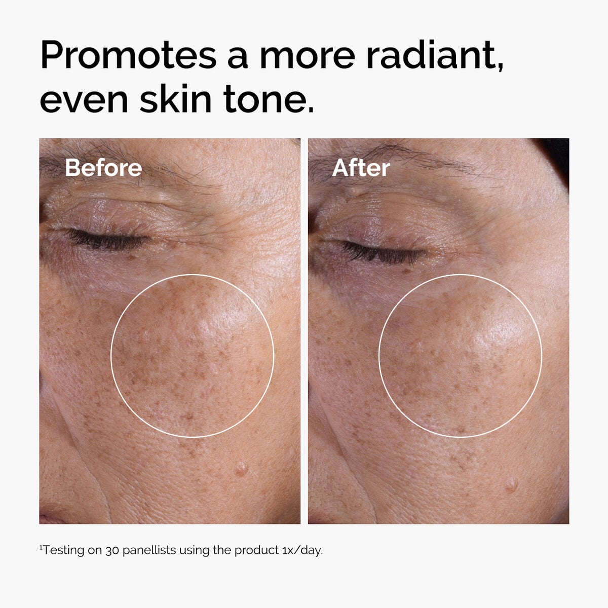 glycolic-acid-7-exfoliating-toner-j6 ord-glycolic-before-after-radiance.jpg