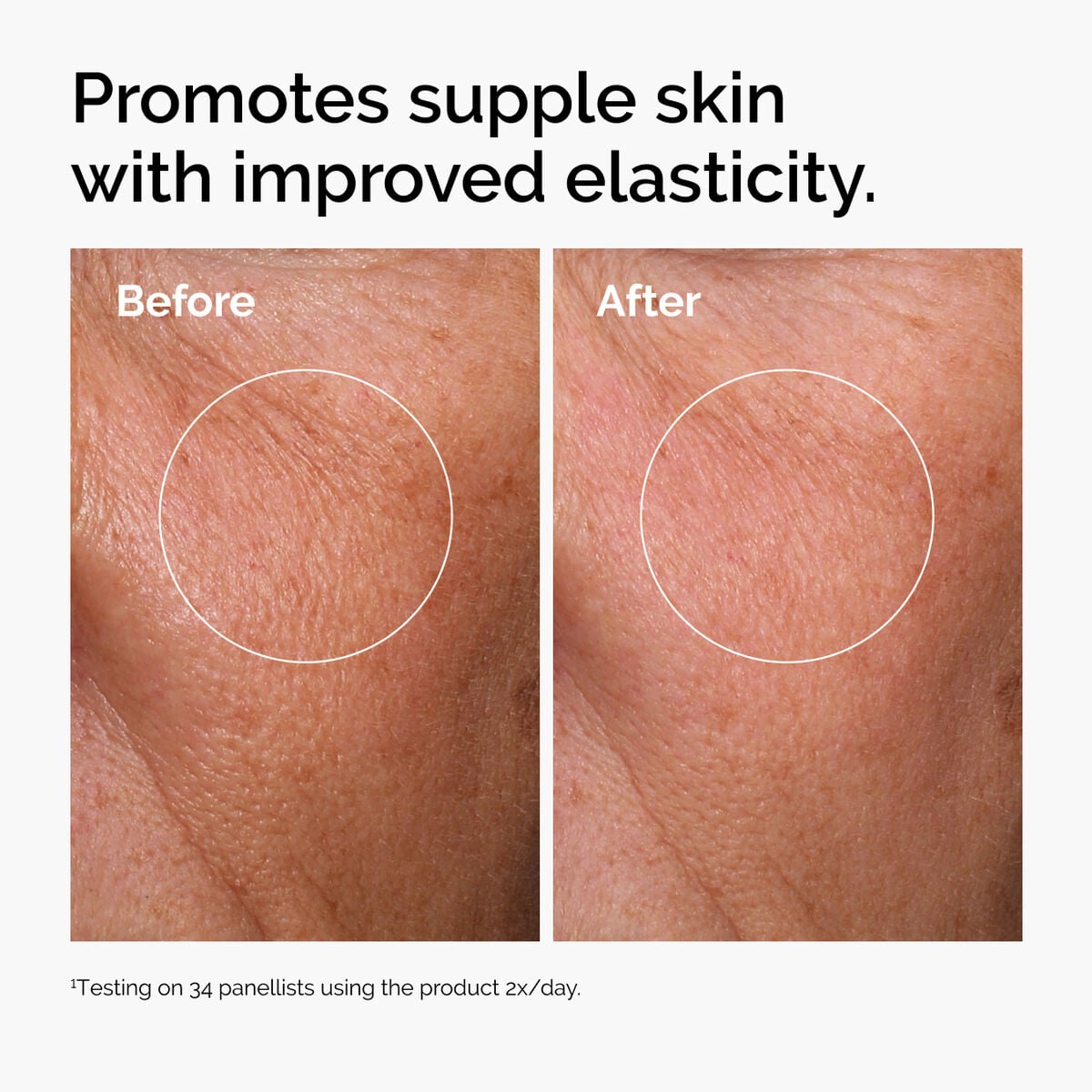 hyaluronic-acid-2-b5-with-ceramides-w9 ord-hyaluronic-acid-2pct-b5-hydrating-serum-before-after-elasticity.jpg