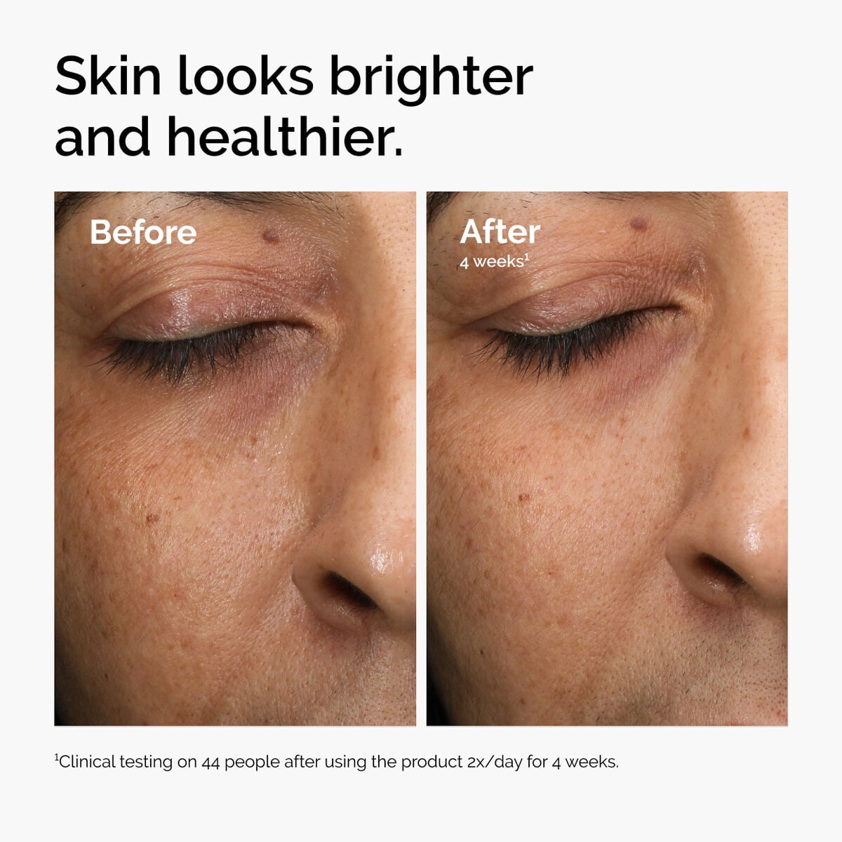 multi-antioxidant-radiance-serum-e3 ord-mars-before-after-healthy.jpg