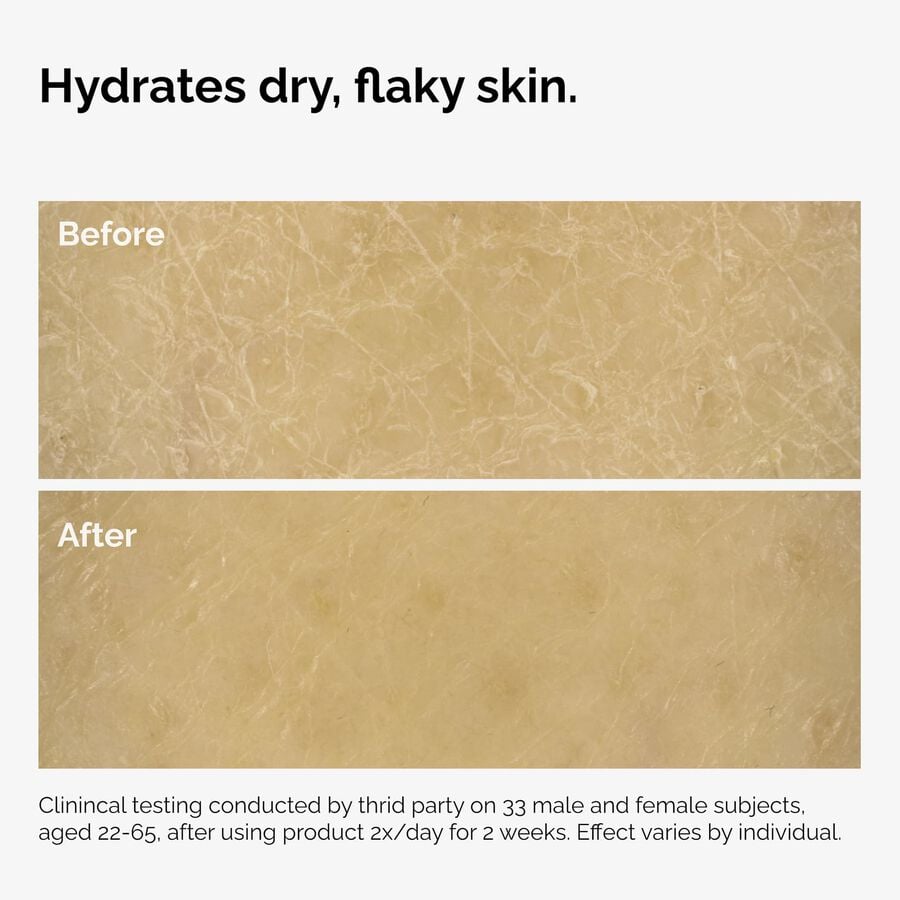 the-body-care-collection-l0 ord-natural-moisturizing-factors-inulin-body-before-after-graphic-02.jpg