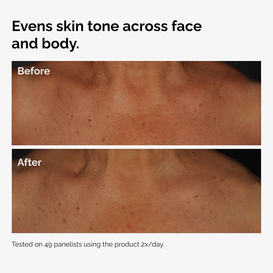 the-body-care-collection-l0 ord-niacinamide-face-body-serum-before-after-even-tone-graphic.jpg