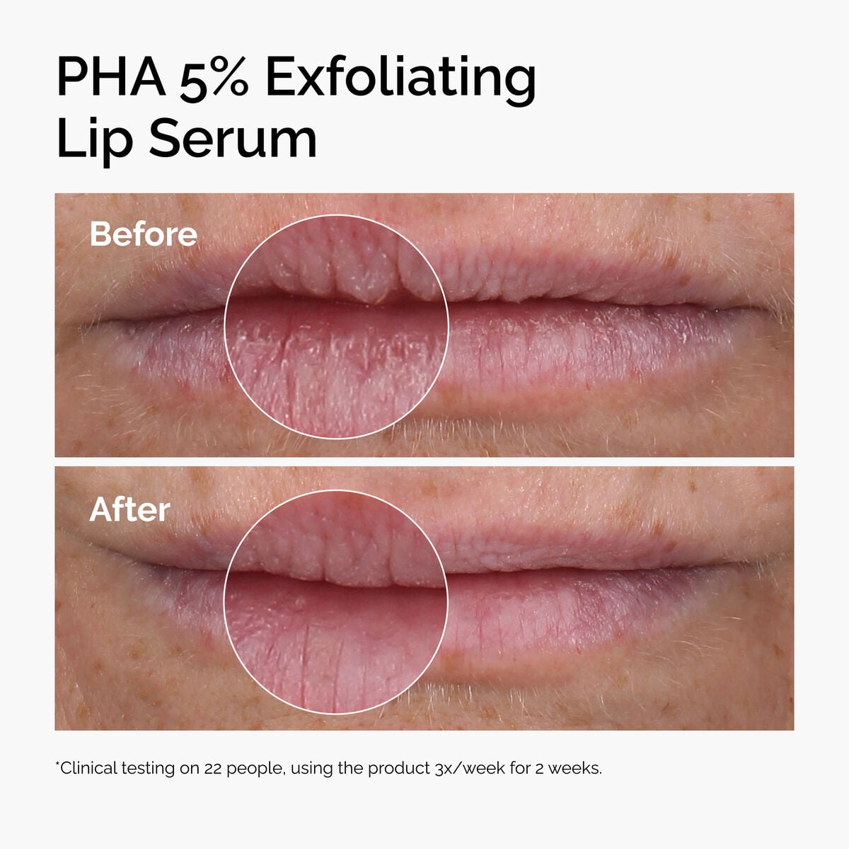 pha-5-exfoliating-lip-serum-q3 ord-pha-5pct-lip-exfoliating-serum-before-after.jpg