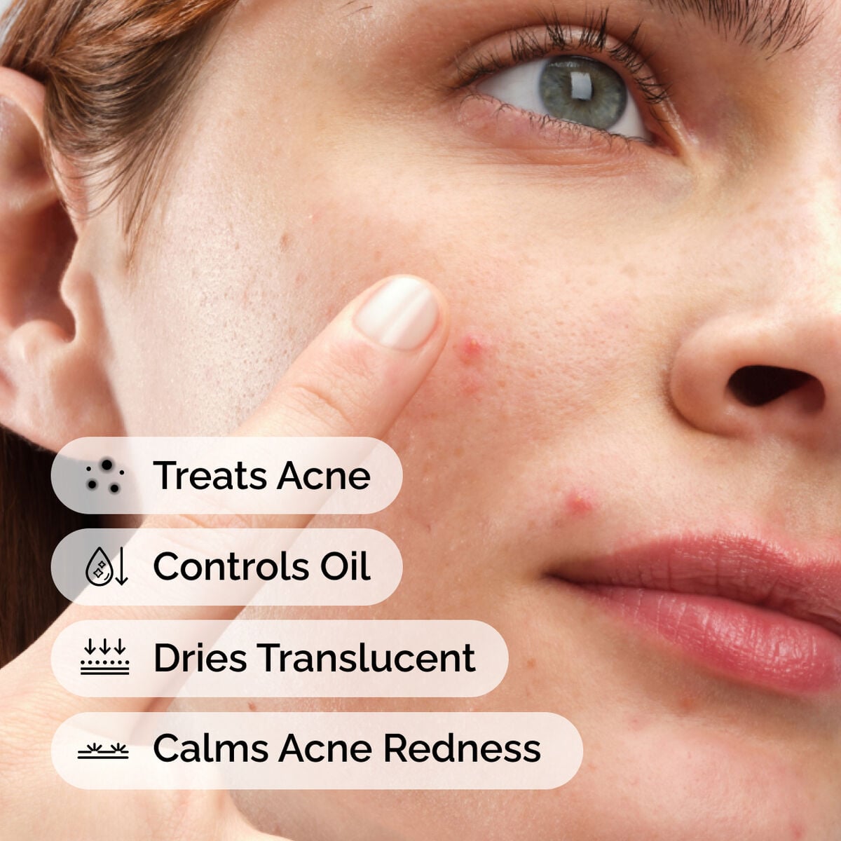 sulfur-10-powder-to-cream-concentrate-x5 ord-sulfur-10pct-powder-to-cream-concentrate-model-application-with-benefits-acne.jpg